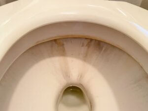 汚れが気になる